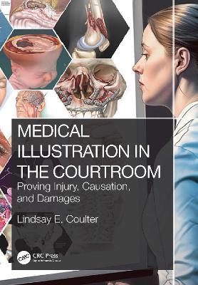 Medical Illustration in the Courtroom: Proving Injury, Causation, and Damages - Lindsay E. Coulter - cover