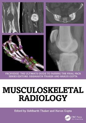 Musculoskeletal Radiology: An Ultimate Guide to Passing the Final FRCR - cover