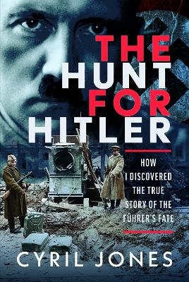 ibs