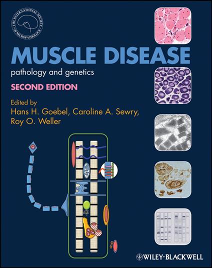 Muscle Disease