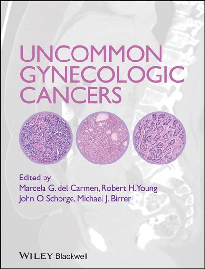 Uncommon Gynecologic Cancers