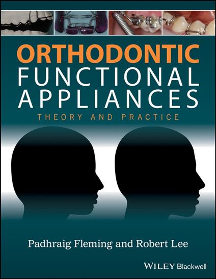 Orthodontic Functional Appliances
