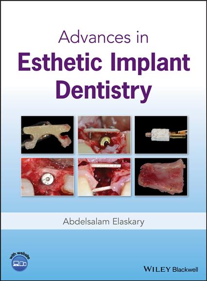 Advances in Esthetic Implant Dentistry