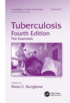 Tuberculosis: The Essentials, Fourth Edition - cover