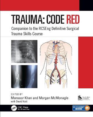 Trauma: Code Red: Companion to the RCSEng Definitive Surgical Trauma Skills Course - cover