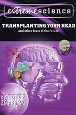 Extreme Science: Transplanting Your Head