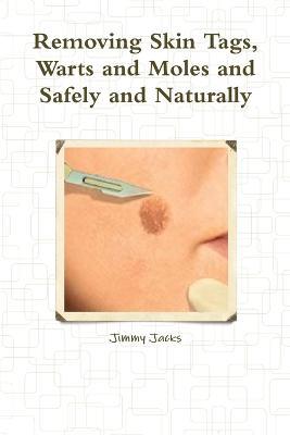 Removing Skin Tags, Warts and Moles and Safely and Naturally - Jimmy Jacks - cover