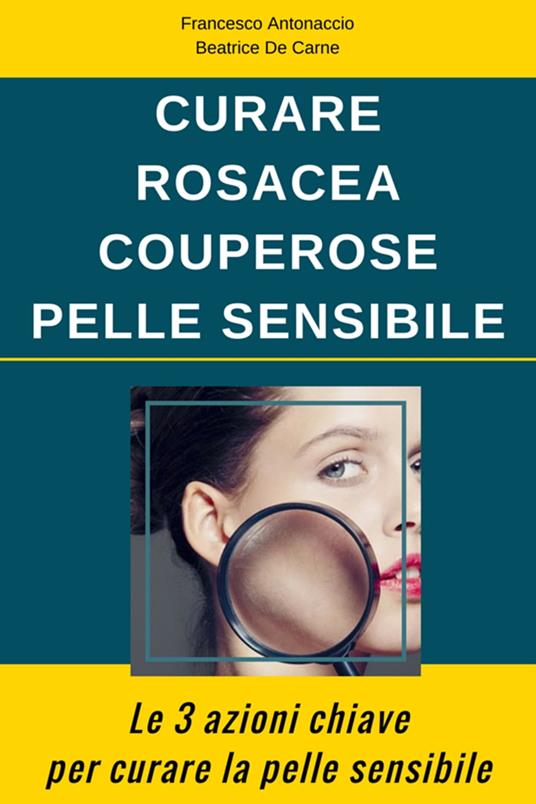 Curare Rosacea Couperose e Pelle Sensibile - Francesco Antonaccio,Beatrice De Carne - ebook