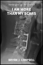 I Am More Than My Scars — Never Give Up On Yourself