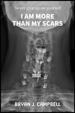 I Am More Than My Scars — Never Give Up On Yourself