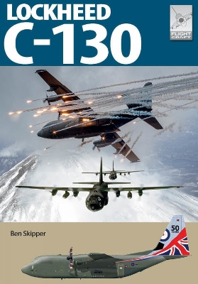 ibs