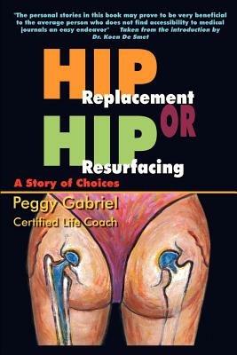Hip Replacement or Hip Resurfacing: A Story of Choices - Peggy Gabriel - cover