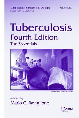 Tuberculosis: The Essentials, Fourth Edition - cover