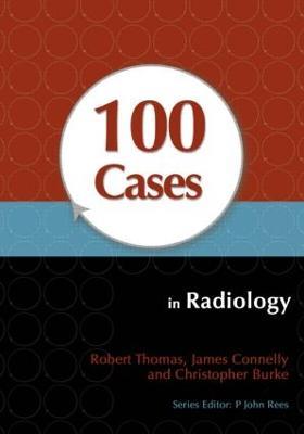 100 Cases in Radiology - Robert Thomas,James Connelly,Christopher Burke - cover