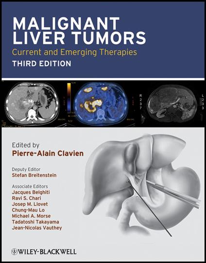 Malignant Liver Tumors
