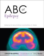 ABC of Epilepsy