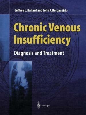 Chronic Venous Insufficiency: Diagnosis and Treatment - cover