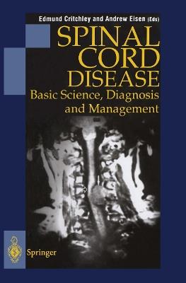 Spinal Cord Disease: Basic Science, Diagnosis and Management - cover