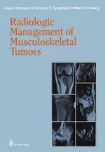Radiologic Management of Musculoskeletal Tumors