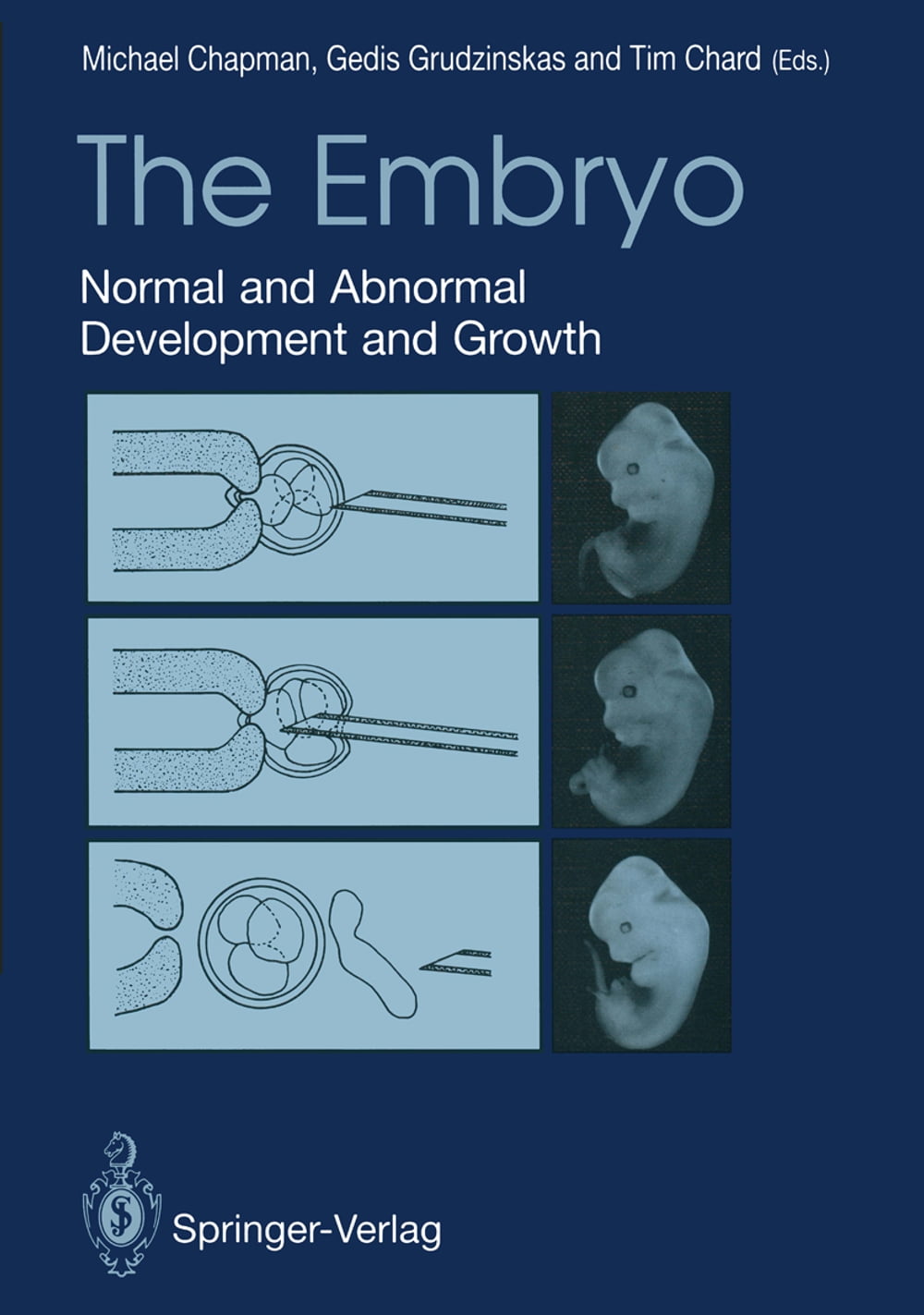 ibs