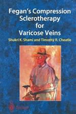 Fegan’s Compression Sclerotherapy for Varicose Veins