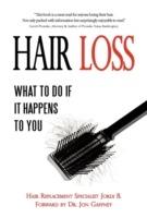 Hair Loss: What to do if it Happens to You