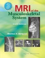 MRI of the Musculoskeletal System - Thomas H. Berquist - cover