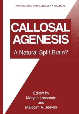 Callosal Agenesis: A Natural Split Brain? - cover