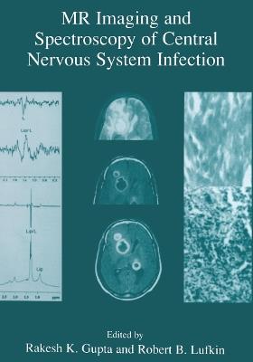 MR Imaging and Spectroscopy of Central Nervous System Infection - cover