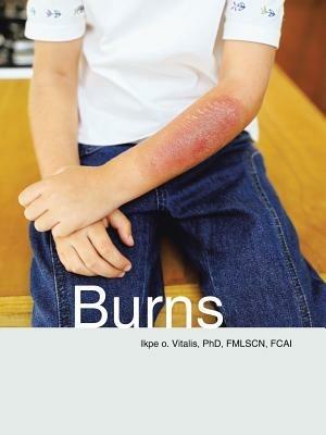 Burns - Phd Fmlscn Vitalis - cover