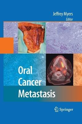 Oral Cancer Metastasis - cover