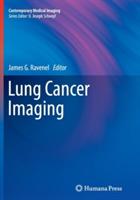 Lung Cancer Imaging - cover