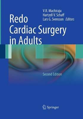 Redo Cardiac Surgery in Adults - cover