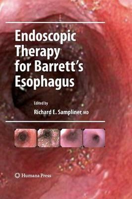 Endoscopic Therapy for Barrett's Esophagus - cover
