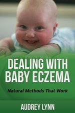 Dealing With Baby Eczema