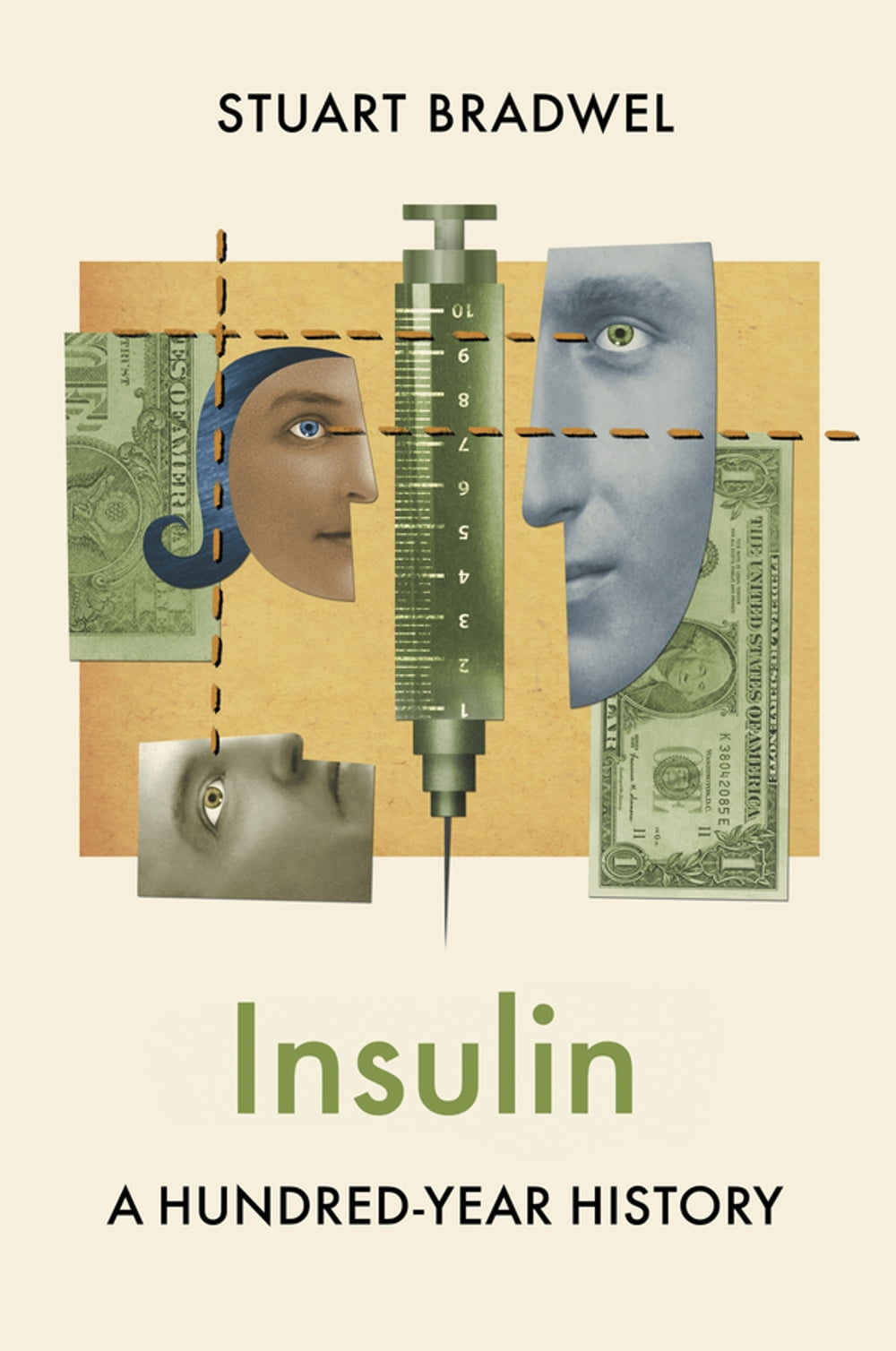 ibs