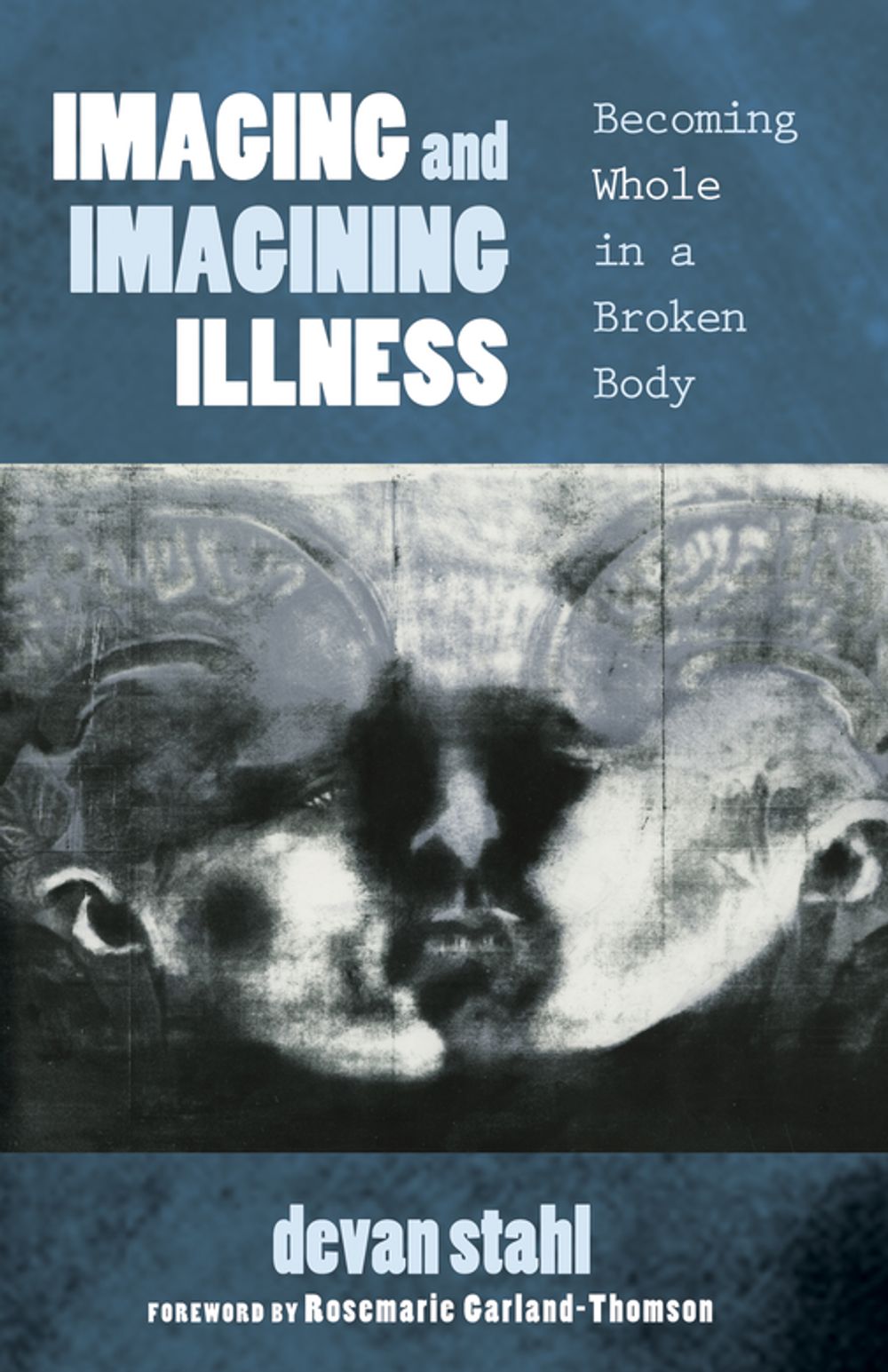 ibs