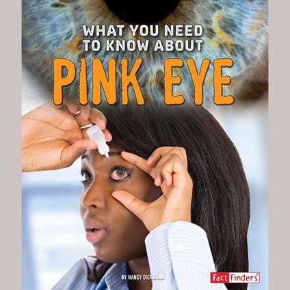 What You Need to Know about Pink Eye