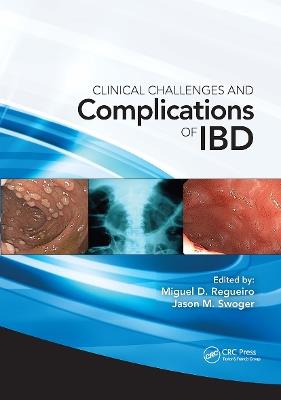 Clinical Challenges and Complications of IBD - Miguel Regueiro,Jason Swoger - cover