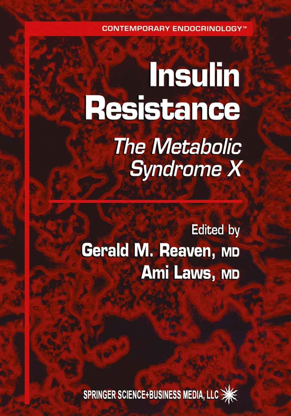ibs