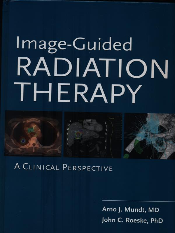 Image guided radiation therapy