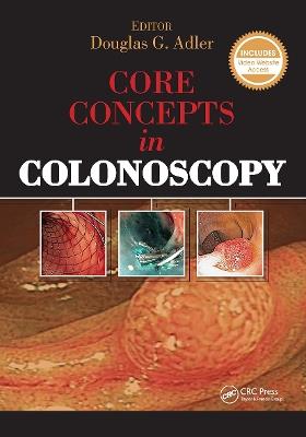 Core Concepts in Colonoscopy - Douglas Adler - cover