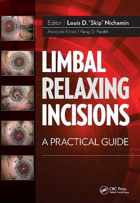 Limbal Relaxing Incisions: A Practical Guide - Louis Nichamin - cover