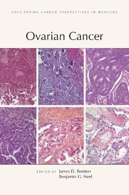 Ovarian Cancer - James D Brenton,Benjamin G Neel,Kathleen R Cho - cover