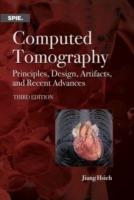 Computed Tomography: Principles, Design, Artifacts, and Recent Advances