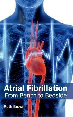 Atrial Fibrillation: From Bench to Bedside - cover