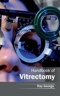 Handbook of Vitrectomy - cover