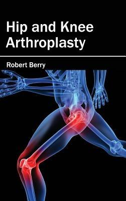 Hip and Knee Arthroplasty - cover