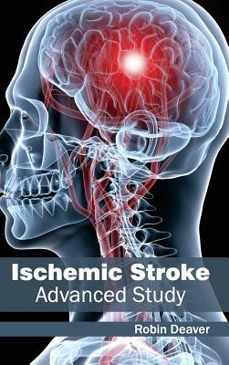 Ischemic Stroke: Advanced Study - cover