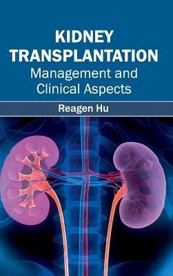 Kidney Transplantation: Management and Clinical Aspects - cover